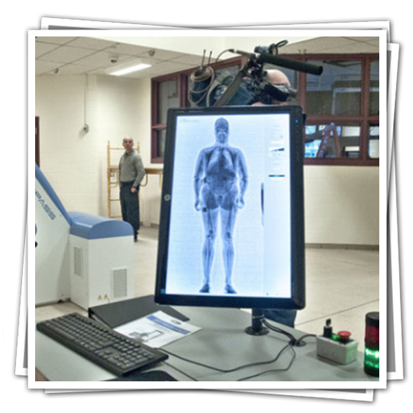 Whole Body X-Ray Scanners